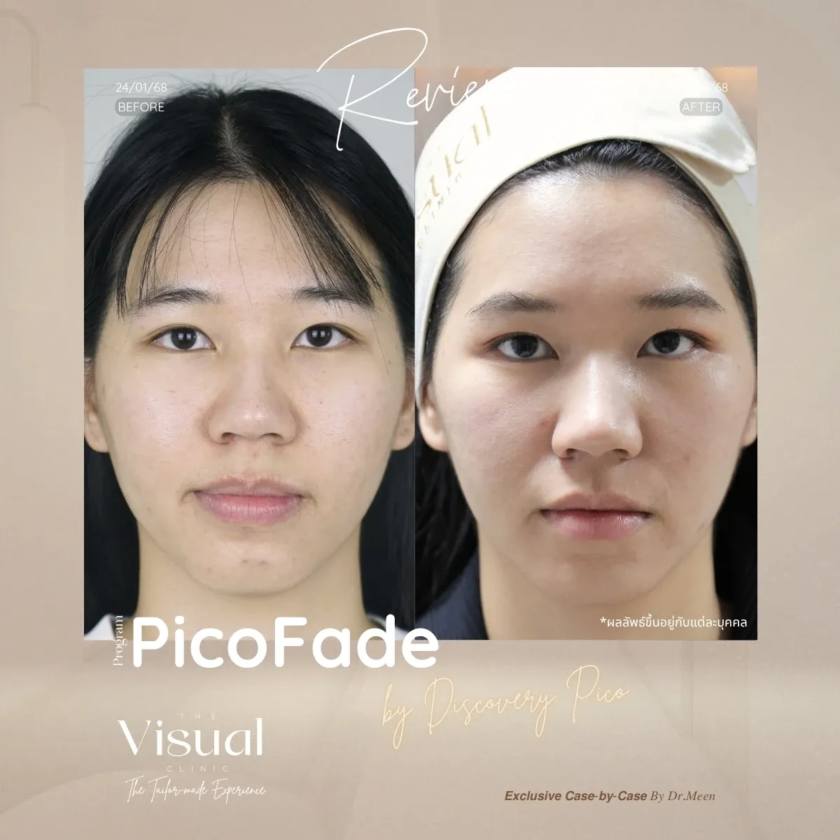 Program Discovery Pico