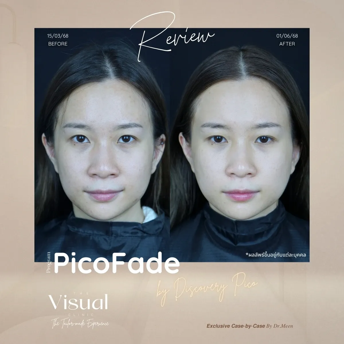 Program Discovery Pico