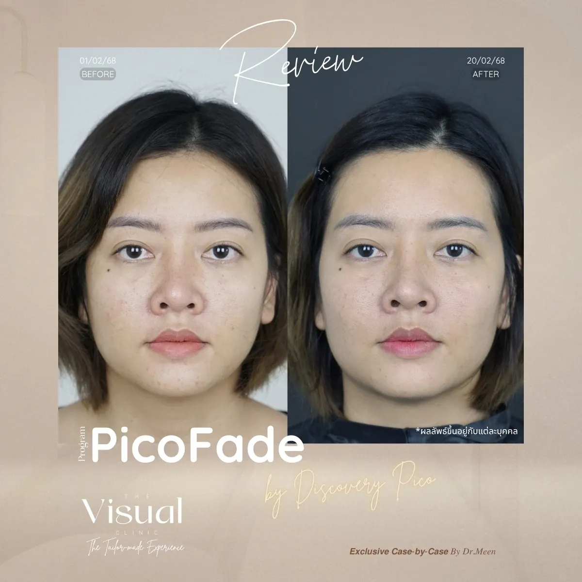 Program Discovery Pico