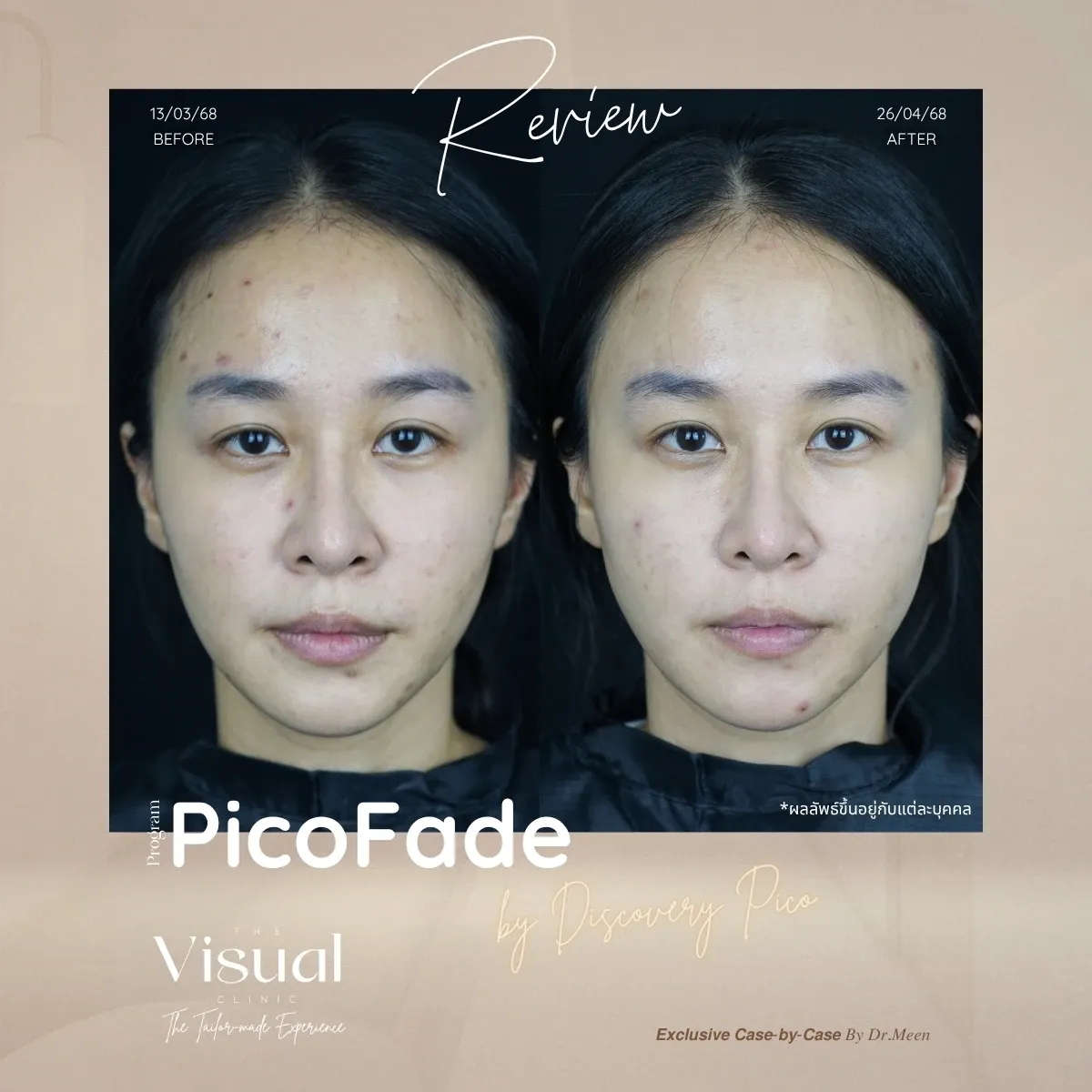 Program Discovery Pico